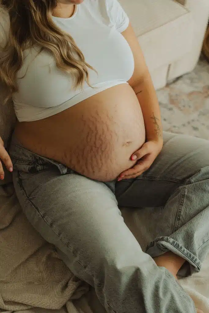 La « photo-thérapie » quand on te retouche à mort, c’est juste du marketing.